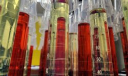 Benefits of Consistent Oil Analysis: Cost-Savings are Just the Beginning